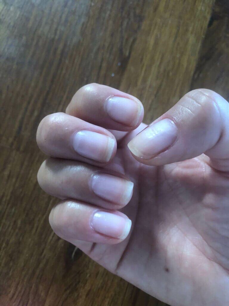 unghie dopo rimozione di maniko nails